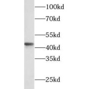 WB analysis of Y79 cells, using SFTPB antibody (1/500 dilution).