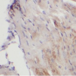 Sarcoglycan Gamma (SGCG) Antibody