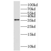 WB analysis of human skeletal muscle tissue, using SGCG antibody (1/600 dilution).
