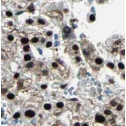 SAGA Complex Associated Factor 29 (SGF29) Antibody