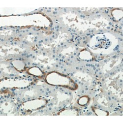 SGLT3/SLC5A4 (SLC5A4) Antibody