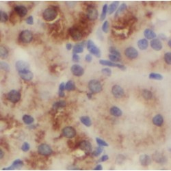 Phosphatidylcholine:ceramide Cholinephosphotransferase 1 (SGMS1) Antibody