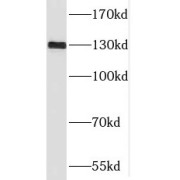 WB analysis of mouse testis tissue, using SGSM1 antibody (1/500 dilution).