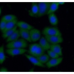 SH2B Adaptor Protein 1 (SH2B1) Antibody