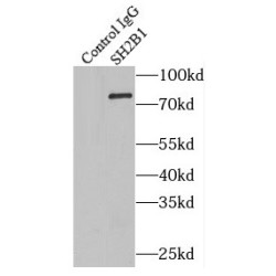 SH2B Adaptor Protein 1 (SH2B1) Antibody