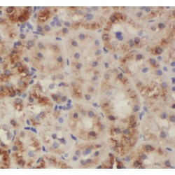 SH2 Domain Containing 1B (SH2D1B) Antibody