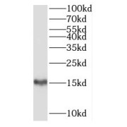 WB analysis of Jurkat cells, using SH2D1B antibody (1/800 dilution).