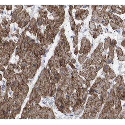 SH2 Domain Containing 2A (SH2D2A) Antibody