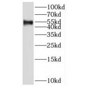 WB analysis of HeLa cells, using SH2D4A antibody (1/500 dilution).