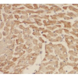 SH3 Domain Binding Glutamate Rich Protein (SH3BGR) Antibody