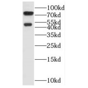 WB analysis of mouse lung tissue, using SH3BP1 antibody (1/500 dilution).