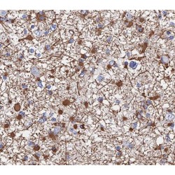 SH3 Domain Containing GRB2 Like 2, Endophilin A1 (SH3GL2) Antibody