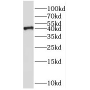 WB analysis of human brain tissue, using SH3GL3 antibody (1/800 dilution).