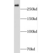 WB analysis of human brain tissue, using SHANK1 antibody (1/300 dilution).