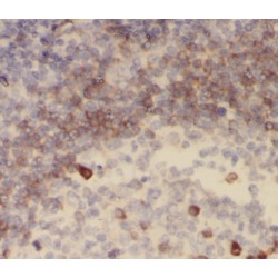 SHC SH2 Domain-Binding Protein 1 (SHCBP1) Antibody