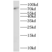 WB analysis of Jurkat cells, using SHCBP1 antibody (1/300 dilution).