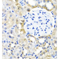 Serine Hydroxymethyltransferase, Cytosolic (SHMT1) Antibody