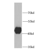 WB analysis of HeLa cells, using SHMT1 antibody (1/1000 dilution).