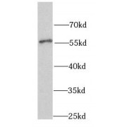 WB analysis of HeLa cells, using SHMT2 antibody (1/1000 dilution).