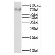 WB analysis of HL-60 cells, using SIGLEC5 antibody (1/500 dilution).