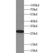 WB analysis of mouse kidney tissue, using SIGMAR1 antibody (1/500 dilution).