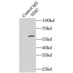 Class E Basic Helix-Loop-Helix Protein 15 (SIM2) Antibody