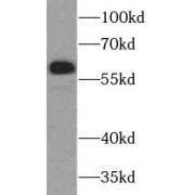 WB analysis of HepG2 cells, using SIM2 antibody (1/1000 dilution).