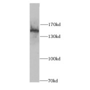 WB analysis of HeLa cells, using SIN3A antibody (1/1000 dilution).