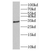 WB analysis of HepG2 cells, using SIP1 antibody (1/500 dilution).