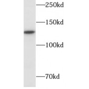 WB analysis of HeLa cells, using SIRT1 antibody (1/3000 dilution).