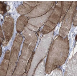 Sirtuin 4 (SIRT4) Antibody