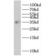 WB analysis of PC-3 cells, using SIRT4 antibody (1/300 dilution).