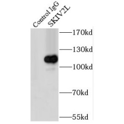 Ski2 Like RNA Helicase (SKIV2L) Antibody