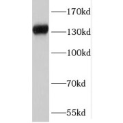 WB analysis of HEK-293 cells, using SKIV2L antibody (1/600 dilution).