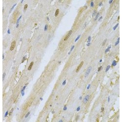 S-Phase Kinase Associated Protein 1 (SKP1) Antibody