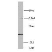 WB analysis of human brain tissue, using SKP1 antibody (1/1000 dilution).