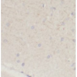 Solute Carrier Family 12 Member 5 (SLC12A5) Antibody