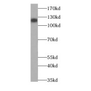 WB analysis of human brain tissue, using SLC12A5-Specific antibody (1/300 dilution).