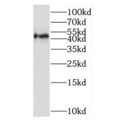 WB analysis of mouse kidney tissue, using SLC16A12 antibody (1/100 dilution).