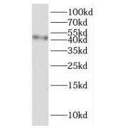 WB analysis of human kidney tissue, using SLC17A5 antibody (1/300 dilution).