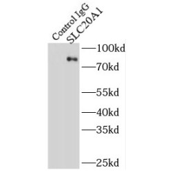Solute Carrier Family 20 Member 1 (SLC20A1) Antibody