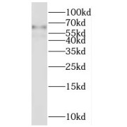 WB analysis of mouse liver tissue, using SLC22A1 antibody (1/600 dilution).