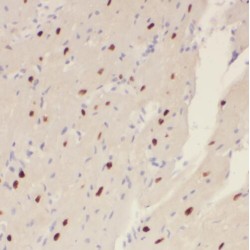 Solute Carrier Family 25 Member 15 (SLC25A15) Antibody