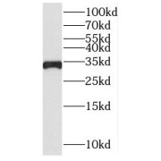 WB analysis of HeLa cells, using SLC25A15 antibody (1/500 dilution).