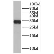 WB analysis of mouse brain tissue, using SLC25A22 antibody (1/1000 dilution).