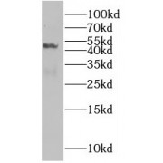 WB analysis of human placenta tissue, using SLC25A24 antibody (1/1500 dilution).