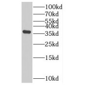 WB analysis of U2Os cells, using SLC25A33 antibody dilution).