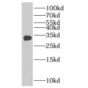 WB analysis of human heart tissue, using ANT1/2 antibody (1/800 dilution).