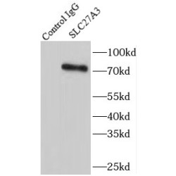 Fatty Acid Transport Protein 3 (SLC27A3) Antibody