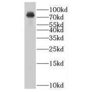 WB analysis of human testis tissue, using SLC27A3 antibody (1/1500 dilution).